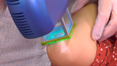 CLINICA-TRAT-DR-VITILIGO-PLAY