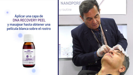 DNA-RECOVERY-PEEL-PLAY