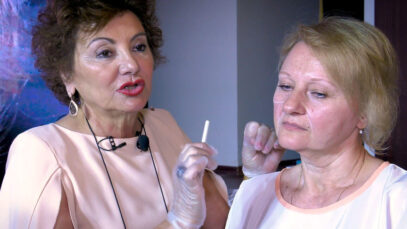 FILLERS-1-redimensionada