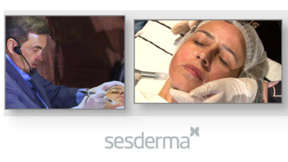 MICRONEEDLING-BRASIL-PLAY
