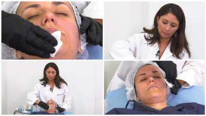 PEELING-AZELAICO-PLAY