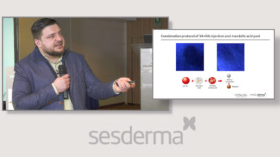 RV-FILLERS-PLAY-e1558532084639